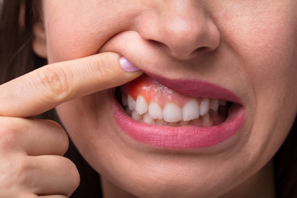 gum cleaning teeth