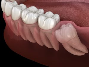 houston oral surgery