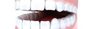 houston dental benefits