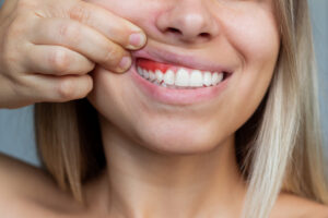 Get help for your gum health at MMC 