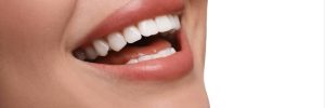houston dental benefits
