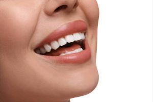 houston dental benefits